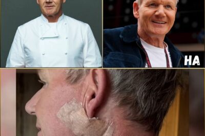 Celebrity Chef Gordon Ramsay Diagnosed with Skin Cancer: A Wake-Up Call for Skin Protection